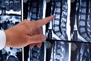 possible complications the